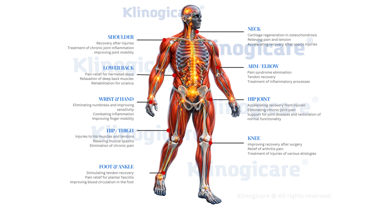 Anatomischer Atlas mit den wichtigsten therapeutischen Anwendungszonen von Quantum Magnetic Storm an Wirbelsäule, Gelenken, peripheren Regionen, großen Muskelgruppen und Beckenboden